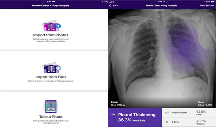 MobileChestX-RayAnalysis_Screenshot1